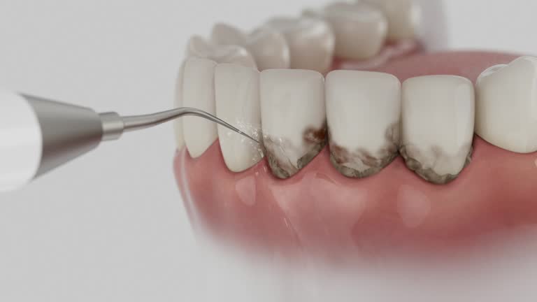 Reliable Dental contractor in La Cresta, CA by Dentist Open Now